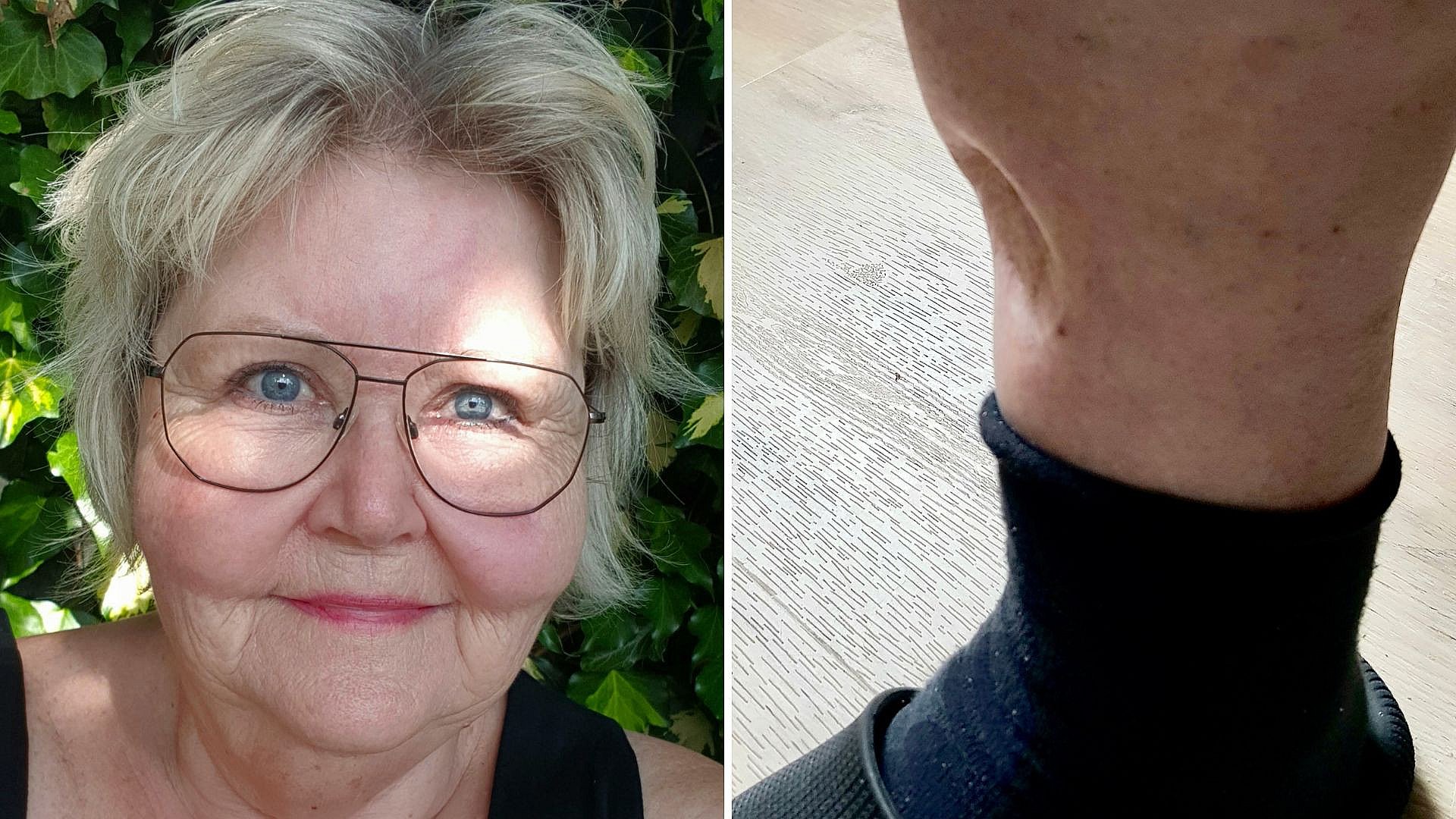 Connie betalte dyr pris for sin brune hud nu advarer hun unge som